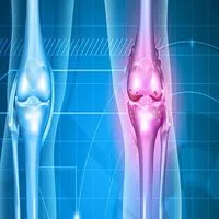 Crèmes et Pommades Anti-inflammatoire